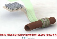 Biodegradable Sensor Can Monitor Blood Flow in Arteries