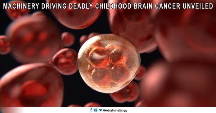 Machinery driving deadly childhood brain cancer unveiled Machinery driving deadly childhood brain cancer unveiled