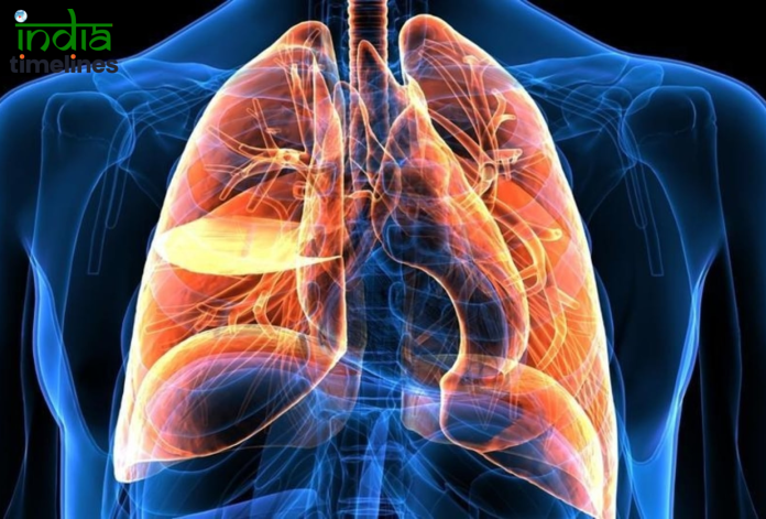 Increasing Cases of Lung Cancer