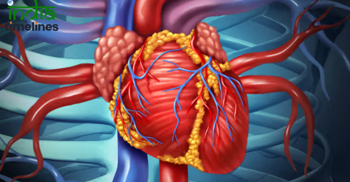 Heart Surgery