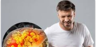 Fatty Liver Diet Hacks