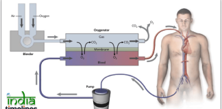 Understanding Extracorporeal Membrane Oxygenation (ECMO) Program Banner