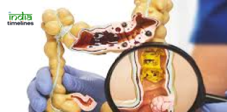 Colorectal Cancer Banner