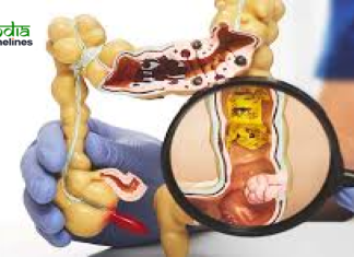Colorectal Cancer Banner