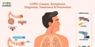 Increased COVID-19 Risk Banner
